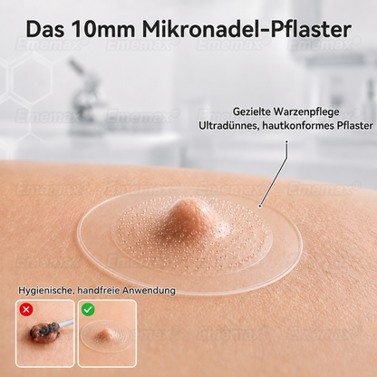 𝐄𝐦𝐞𝐦𝐚𝐱®𝟐-𝐢𝐧-𝟏 𝐌𝐢𝐜𝐫𝐨𝐧𝐞𝐞𝐝𝐥𝐞 & 𝐇𝐲𝐝𝐫𝐨𝐜𝐨𝐥𝐥𝐨𝐢𝐝 𝐌𝐨𝐥𝐞 𝐑𝐞𝐦𝐨𝐯𝐚𝐥 𝐏𝐚𝐭𝐜𝐡(Zero Pain, Zero 𝐒𝐜𝐚𝒓𝒔 patch)💪