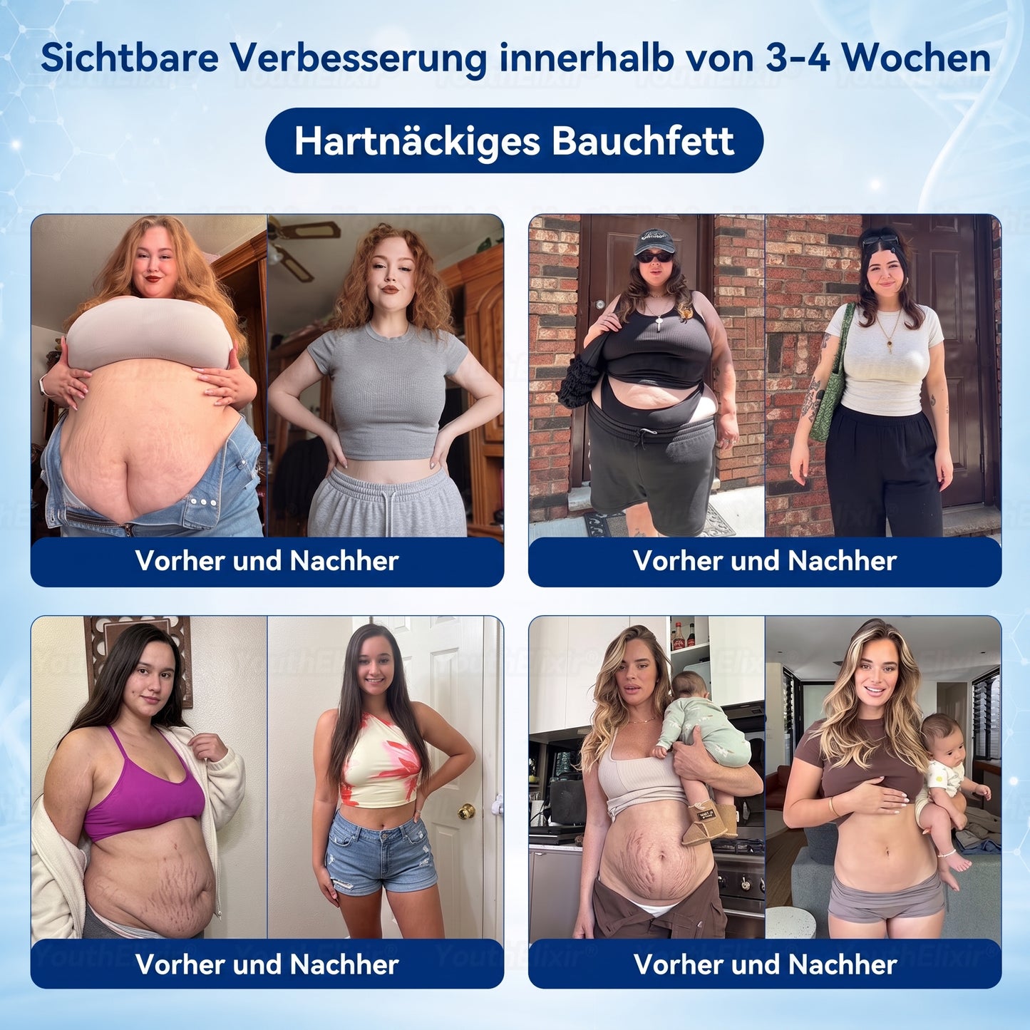 🌻🌻 YouthElixir® Metabolism Navel Drops – Mit hexan-freiem Rizinusöl und Corosolsäure für die Unterstützung der Stoffwechselbalance, des Gewichtsmanagements, der Hautpflege, der Energieversorgung und des allgemeinen Wohlbefindens.