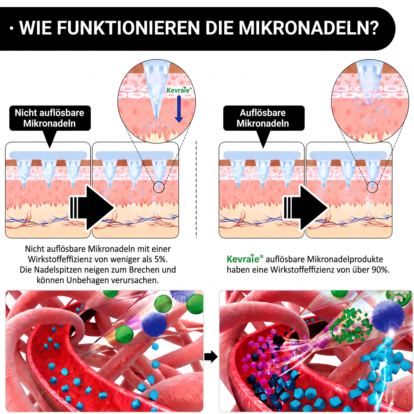 Von Ärzten empfohlen 🌟 | Kevrai® Berberin 10-in-1 Nano-Mikronadelpflaster | ✅ Wissenschaftlich fundierte Formel | Fortschrittliche 10-in-1-Mischung | Sichtbare Ergebnisse in 7 Tagen 🏅