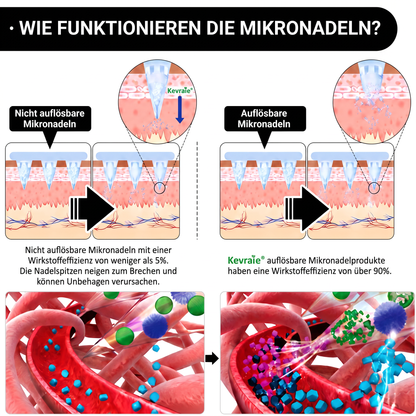 Von Ärzten empfohlen 🌟 | Kevrai® Berberin 10-in-1 Nano-Mikronadelpflaster | ✅ Wissenschaftlich fundierte Formel | Fortschrittliche 10-in-1-Mischung | Sichtbare Ergebnisse in 7 Tagen 🏅