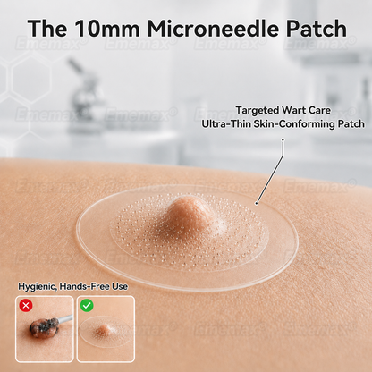 𝐄𝐦𝐞𝐦𝐚𝐱®𝟐-𝐢𝐧-𝟏 𝐌𝐢𝐤𝐫𝐨𝐧𝐚𝐝𝐞𝐥- & 𝐇𝐲𝐝𝐫𝐨𝐤𝐨𝐥𝐥𝐨𝐢𝐝-𝐌𝐨𝐥𝐞𝐧𝐞𝐧𝐭𝐟𝐞𝐫𝐧𝐮𝐧𝐠𝐬𝐩𝐟𝐥𝐚𝐬𝐭𝐞𝐫 (𝐒𝐜𝐡𝐦𝐞𝐫𝐳𝐟𝐫𝐞𝐢, 𝐍𝐚𝐫𝐛𝐞𝐧𝐟𝐫𝐞𝐢𝐞 𝐏𝐟𝐥𝐚𝐬𝐭𝐞𝐫)💪