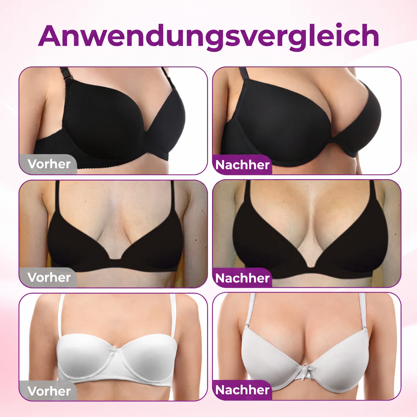 💥Turonu® 💗 Targeted Breast Enhancement Advanced Nano Microneedle Patch💃