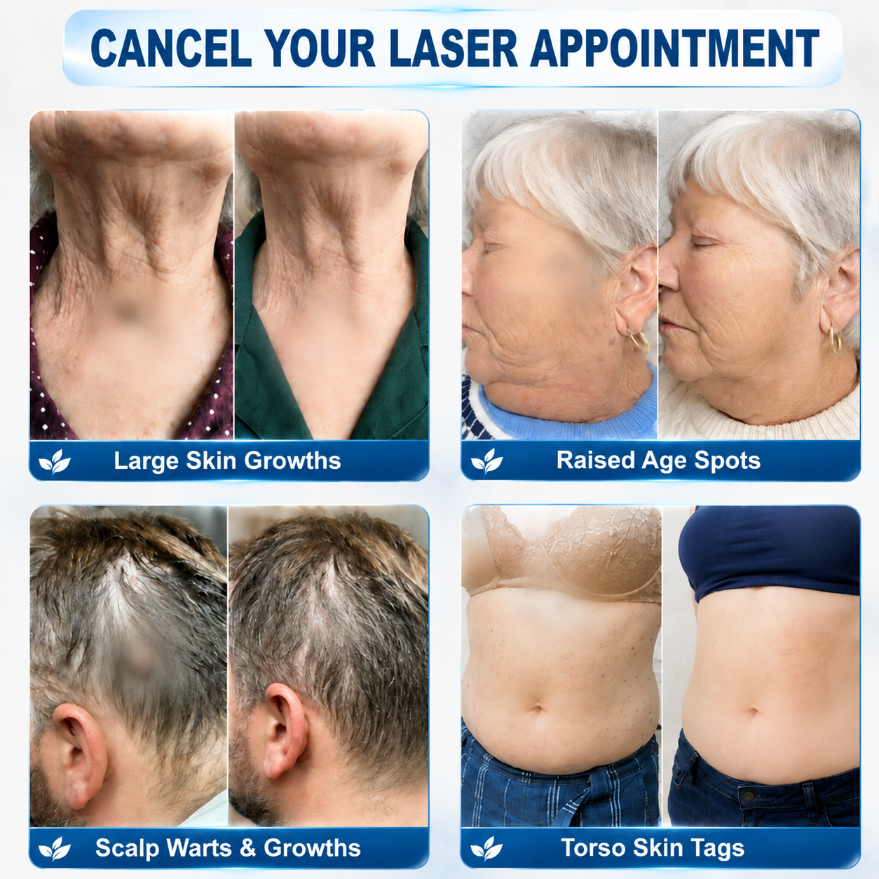 𝐄𝐦𝐞𝐦𝐚𝐱®𝟐-𝐢𝐧-𝟏 𝐌𝐢𝐤𝐫𝐨𝐧𝐚𝐝𝐞𝐥- & 𝐇𝐲𝐝𝐫𝐨𝐤𝐨𝐥𝐥𝐨𝐢𝐝-𝐌𝐨𝐥𝐞𝐧𝐞𝐧𝐭𝐟𝐞𝐫𝐧𝐮𝐧𝐠𝐬𝐩𝐟𝐥𝐚𝐬𝐭𝐞𝐫 (𝐒𝐜𝐡𝐦𝐞𝐫𝐳𝐟𝐫𝐞𝐢, 𝐍𝐚𝐫𝐛𝐞𝐧𝐟𝐫𝐞𝐢𝐞 𝐏𝐟𝐥𝐚𝐬𝐭𝐞𝐫)💪