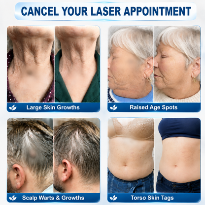 𝐄𝐦𝐞𝐦𝐚𝐱®𝟐-𝐢𝐧-𝟏 𝐌𝐢𝐤𝐫𝐨𝐧𝐚𝐝𝐞𝐥- & 𝐇𝐲𝐝𝐫𝐨𝐤𝐨𝐥𝐥𝐨𝐢𝐝-𝐌𝐨𝐥𝐞𝐧𝐞𝐧𝐭𝐟𝐞𝐫𝐧𝐮𝐧𝐠𝐬𝐩𝐟𝐥𝐚𝐬𝐭𝐞𝐫 (𝐒𝐜𝐡𝐦𝐞𝐫𝐳𝐟𝐫𝐞𝐢, 𝐍𝐚𝐫𝐛𝐞𝐧𝐟𝐫𝐞𝐢𝐞 𝐏𝐟𝐥𝐚𝐬𝐭𝐞𝐫)💪
