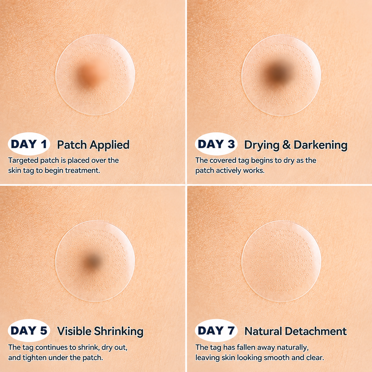 𝐄𝐦𝐞𝐦𝐚𝐱®𝟐-𝐢𝐧-𝟏 𝐌𝐢𝐤𝐫𝐨𝐧𝐚𝐝𝐞𝐥- & 𝐇𝐲𝐝𝐫𝐨𝐤𝐨𝐥𝐥𝐨𝐢𝐝-𝐌𝐨𝐥𝐞𝐧𝐞𝐧𝐭𝐟𝐞𝐫𝐧𝐮𝐧𝐠𝐬𝐩𝐟𝐥𝐚𝐬𝐭𝐞𝐫 (𝐒𝐜𝐡𝐦𝐞𝐫𝐳𝐟𝐫𝐞𝐢, 𝐍𝐚𝐫𝐛𝐞𝐧𝐟𝐫𝐞𝐢𝐞 𝐏𝐟𝐥𝐚𝐬𝐭𝐞𝐫)💪